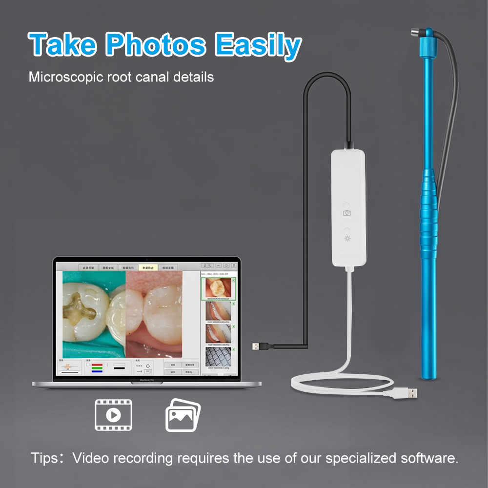 5MP Micro Intraoral Camera Den - Mini Pc Windows のレビューと価格